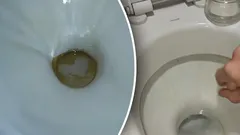 Gula fläckar försvinner på mindre än en timme: det här ska du hälla i toaletten