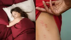 Dolda skadedjur i sängen: Så upptäcker du och blir effektivt av med dammkvalster